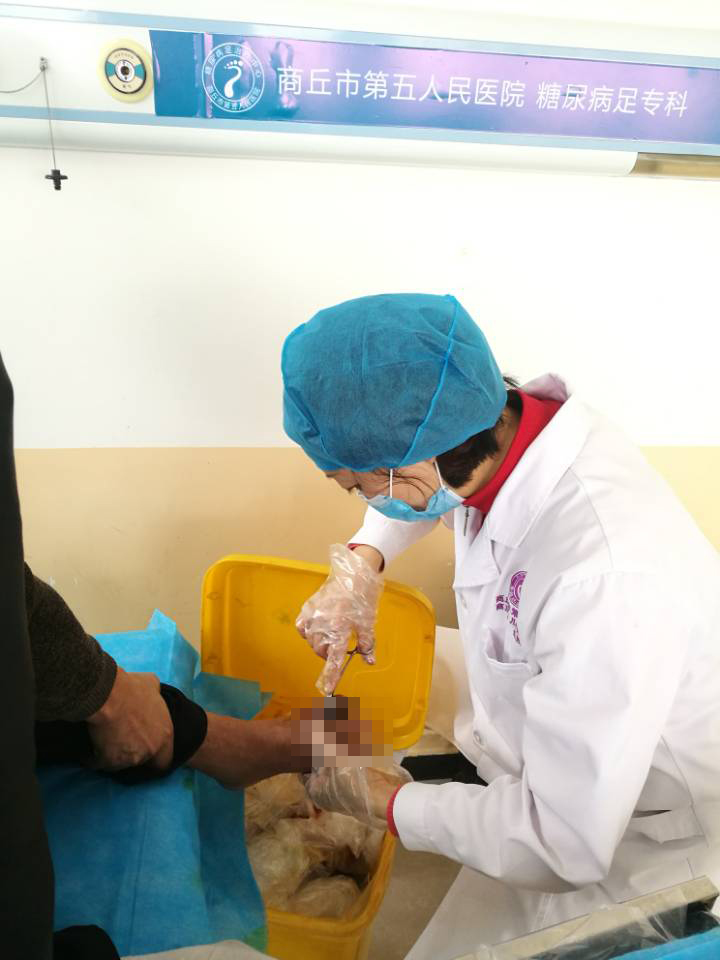 糖尿病烂脚合并尿毒症病人的治疗经历,最后还是中医保守治好了