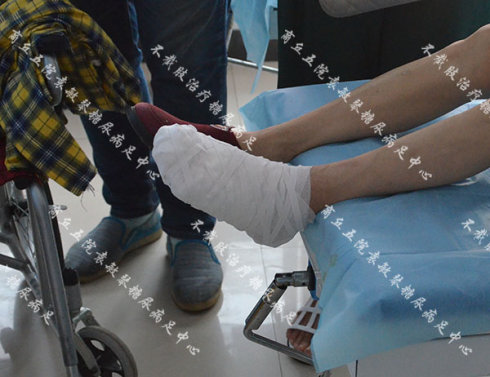 糖尿病人脚趾缝流脓流水溃疡一直无法痊愈的情况要怎么治疗？