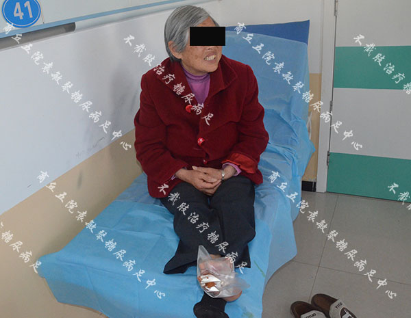 糖尿病足下肢血管闭塞,做支架疏通无效面临截肢