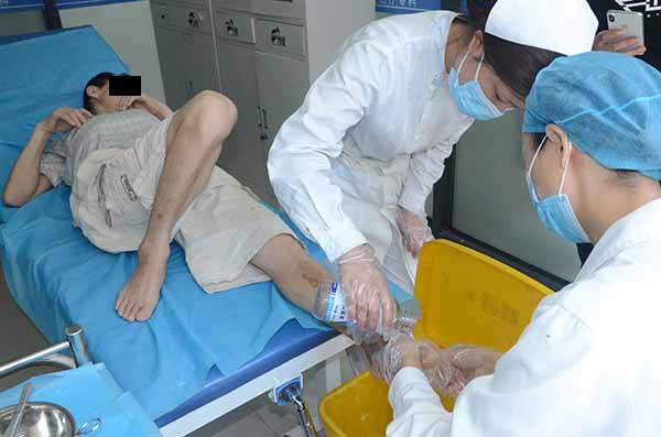 袁敏琴:糖尿病足患者在治疗期间多运动有利于伤口康复!
