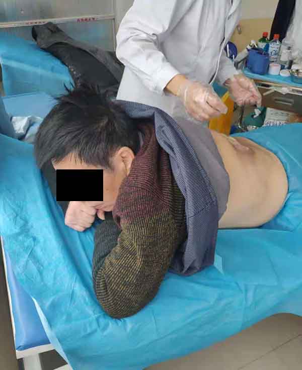 康复案例:糖尿病人后背伤口感染做骨水泥和负压引流越治越严重的治疗