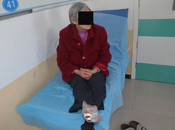 糖尿病足严重的话是否需要截肢?看一个内分泌科医生是怎么回答的!