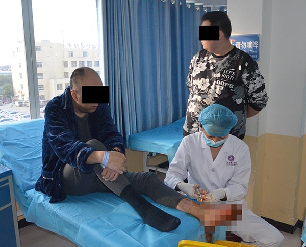 治疗糖尿病足用中药水泡脚有没有好的治疗效果?