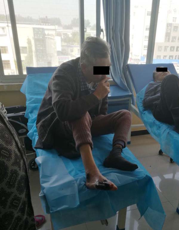 新疆克拉玛依糖尿病足患者到商丘接受中西医结合保肢治疗!